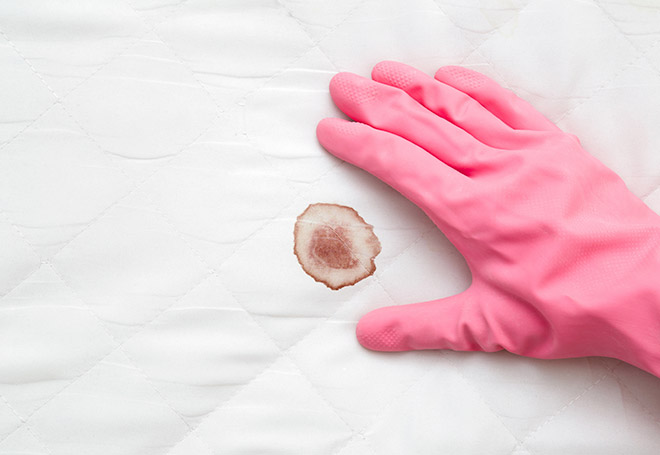 Remoção de manchas